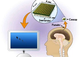 Схема устройства BrainGate (иллюстрация Nature).